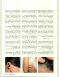 LEO Pharma - Zahrat Al Khaleej - January 2017 - Page 107